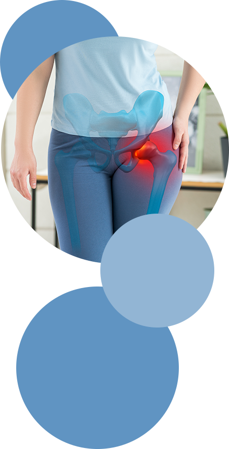 img_osteoartosi Agen Biotech ossa e articolazioni