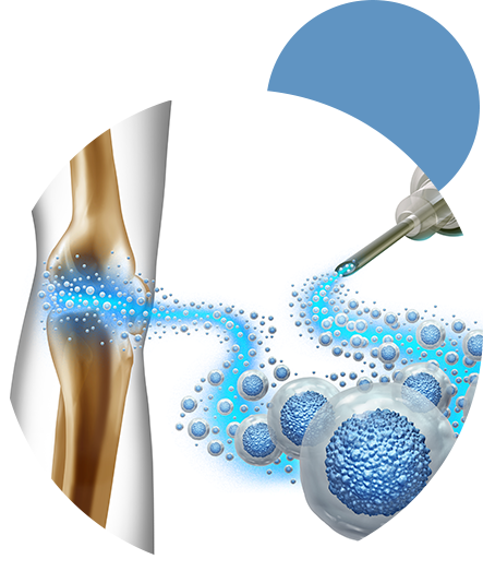 patologie_terapiainfiltrativa